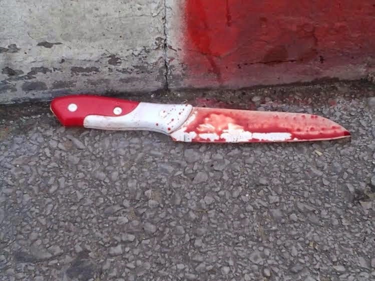 פיגועים גם בחו"ל: חסיד בעלז נדקר בצווארו